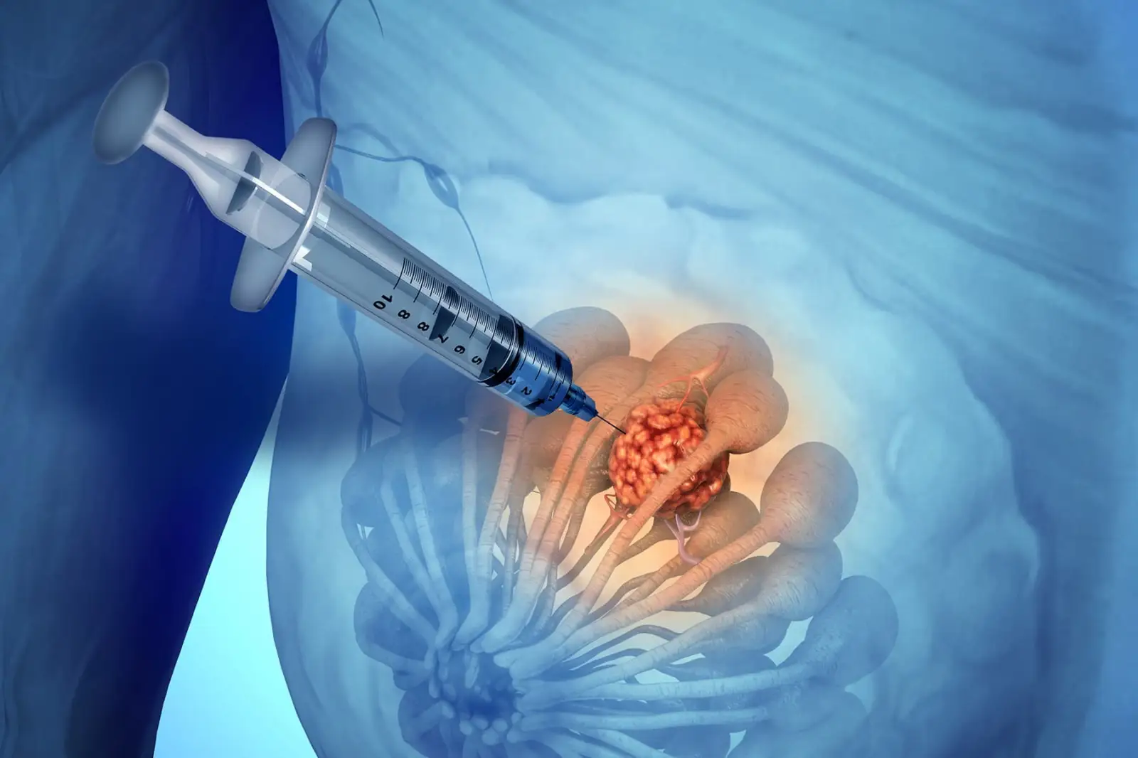 بیوپسی بافت