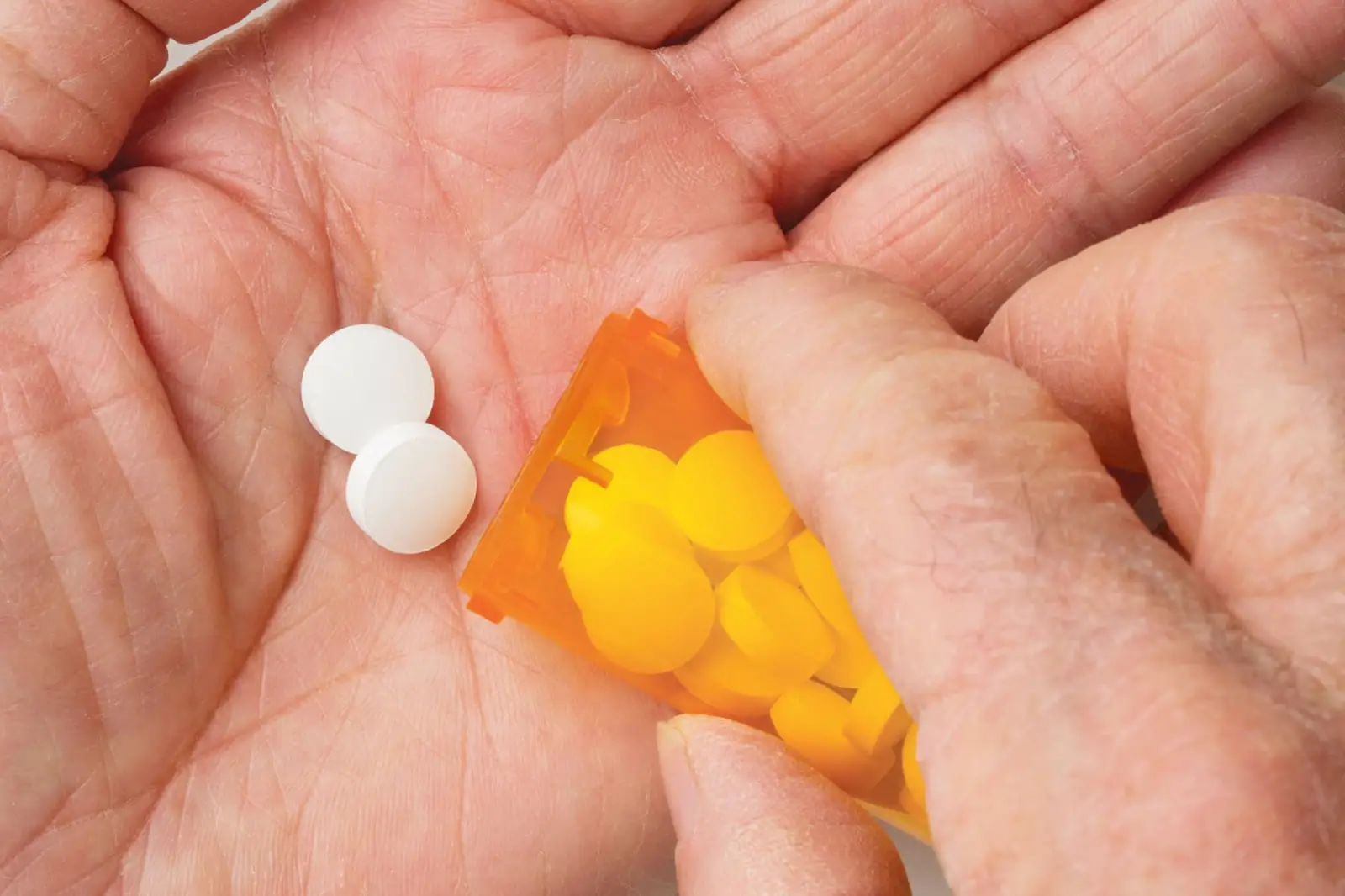 بیوپسی بافت