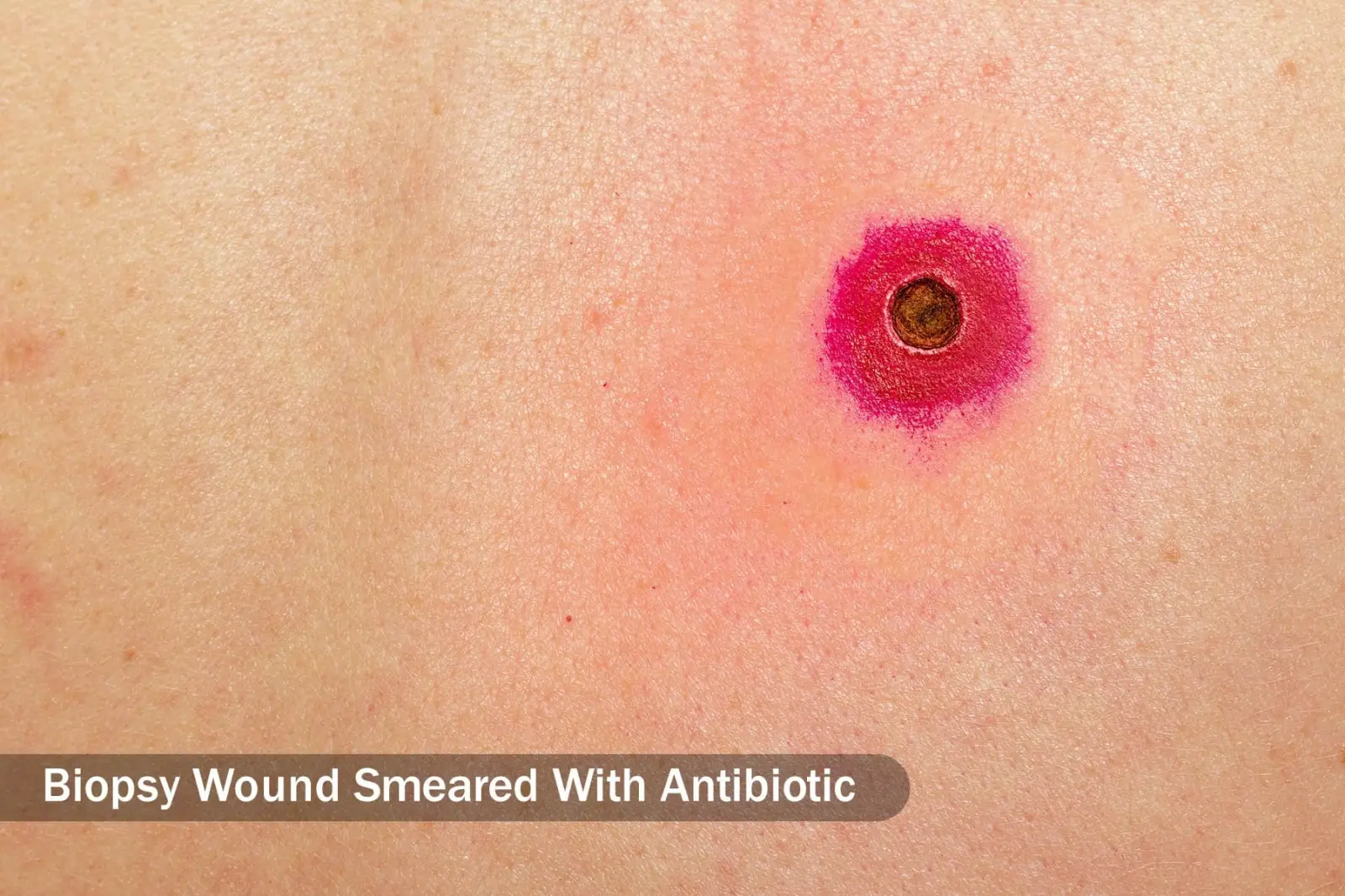 بیوپسی بافت