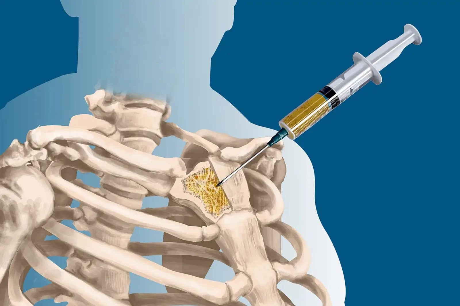 بیوپسی بافت